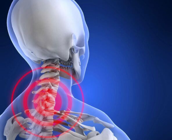 osteohondroza vratne kralježnice