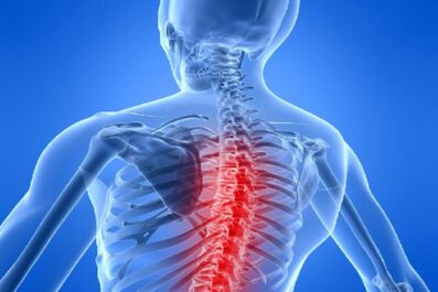 Kompresija leđne moždine u torakalnoj osteohondrozi
